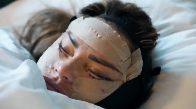 Katie Price surgery