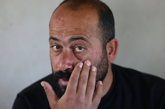 Palestinian filmmaker and Oscar winner for the documentary "No Other Land" Hamdan Ballal shows his bodily injuries after Israeli settlers attacked him at home in his village of Susya in the south of the occupied West Bank on March 26, 2025. Israeli police released Ballal on March 25, after detaining him a day earlier for "hurling rocks" following what activists described as an attack by settlers in the occupied West Bank. (Photo by HAZEM BADER / AFP) (Photo by HAZEM BADER/AFP via Getty Images)